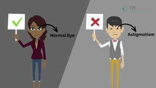 What is Astigmatism [upl. by Yeniffit]