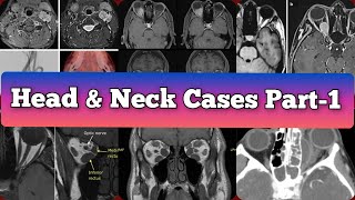 Radiology Viva Cases  367 375  Head and Neck Exam Cases Part 1 medical radiology [upl. by Nagaet]