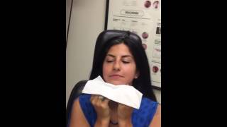 Nasal Splint removal  Post Surgery Septoplasty Rhinoplasty Full Video [upl. by Ariahay]