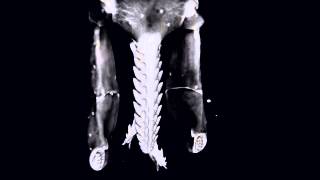 Rendering of the hypostome chelicerae and palps of a nymphal Ixodes ricinus tick [upl. by Zucker]