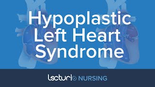 Hypoplastic Left Heart Syndrome Bens Story [upl. by Rufus161]