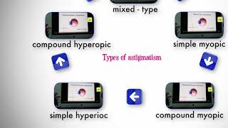 Types of astigmatism [upl. by Floro]