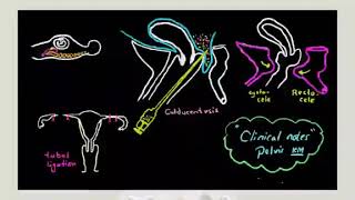 Clinical Notes Of Pelvis amp Perineum By Dr Khaled Milad [upl. by Irme374]