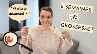 🤰🏼6 SA DE GROSSESSE symptôme précoce échographie de datation… [upl. by Marijane]