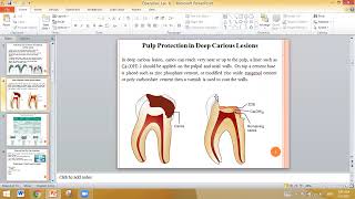 Operative Dentistry Lec 8 Dental Cements liner materials [upl. by Eecyaj]