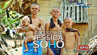 Kapuso Mo Jessica Soho The rare case of poreless skin in four siblings [upl. by Nlycaj33]