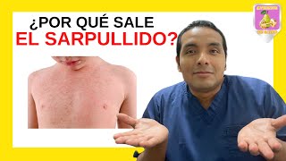 🔴 SABÍAS  ¿Por qué sale el SARPULLIDO  Dr Elmer H Luna Vilchez [upl. by Venterea]