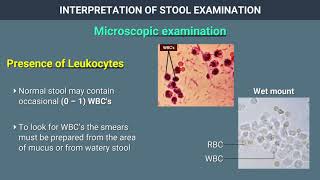 Interpretation of Stool Examination [upl. by Kinimod883]