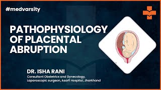 Pathophysiology of Placental Abruption  Case Discussion [upl. by Lawrence]