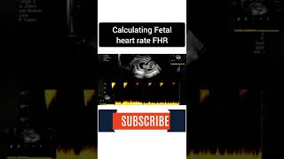 Fetal heart rate FHR ultrasound baby medical pregnancyjourney [upl. by Enyal]