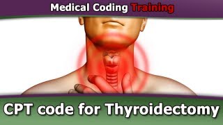 CPT Code for Thyroidectomy — CPT Coding Guidelines [upl. by Amimej887]