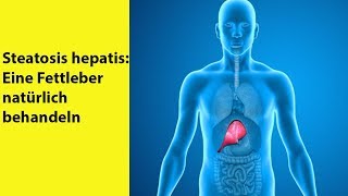 Steatosis hepatis Eine Fettleber natürlich behandeln  Gesundheit [upl. by Dazhahs]