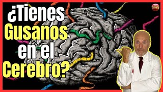 🔴 NEUROCISTICERCOSIS o CISTICERCOSIS CEREBRAL CUANDO LOS GUSANOS INVADEN NUESTRO CEREBRO 🔴 [upl. by Leonsis280]