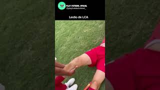 Lesão do ligamento cruzado anterior futebol neymar cristianoronaldo messi [upl. by Ahsirt499]