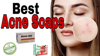 Top 13 Soaps for Acne 2020 Best Soap Bars for Oily Acne prone skin amp Blackheads Sri Lanka [upl. by Nitsej479]