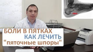 Боли в пятках лечение Пяточные шпоры  как их лечить [upl. by Airlee]