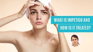 Impetigo Causes Symptoms Treatments [upl. by Junna445]