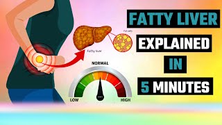 The Shocking Fatty Liver Truth EXPERTS Are Hiding [upl. by Euqilegna]