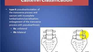 Lumbosacral Transitional Vertebra [upl. by Miarfe]