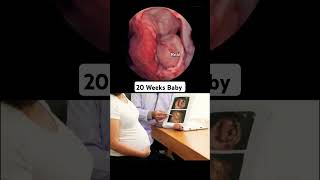 20 Weeks Baby In Mothers Womb Pregnancy Ultrasound 15 baby girl boy babygirl babyboy [upl. by Acirt]