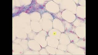 Loose c t  Adipose tisse Massons Trichrome Adipose tissue [upl. by Brooks276]