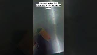 Haematology Practical Preparation of Peripheral Blood Smear in MBBS medico shorts [upl. by Allianora]