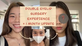 Double Eyelid Surgery in KL amp Recovery 1 month update [upl. by Dottie347]