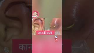 How to Heal Infected EarNose Piercing Fast  Pus  Bump Bleeding swelling Aftercare [upl. by Anak]