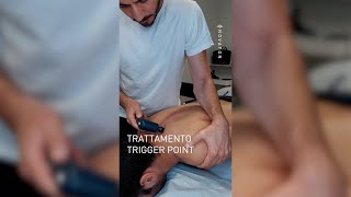 Trattamento Trigger point con NOVAFON [upl. by Arak]