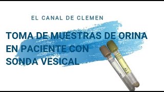 Toma de muestras de orina 🧫🧪en paciente con sonda vesical ❌🚽 [upl. by Celene]