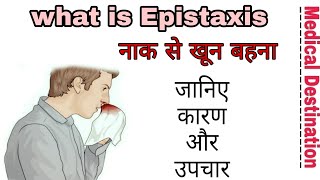 Epistaxis in hindi  Medical destination [upl. by Aural967]