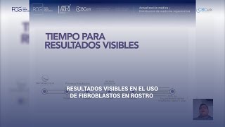 Resultados visibles en el uso de fibroblastos en rostro 🧬 [upl. by Ahsier]