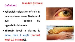 Bile Pigments And Jaundice [upl. by Leela]