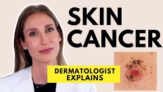 Skin Cancer Different Types Causes Prevention amp Treatments  Dr Sam Ellis [upl. by Bren]