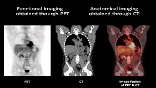 Radiology Ltd Positron Emission Tomography PET What to Expect [upl. by Alleiram]