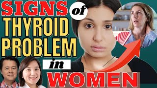 Signs of Thyroid Problem in Women  by Dr Ivy Amante and Doc Willie Ong [upl. by Haym]