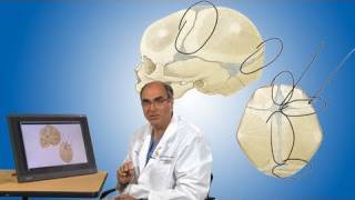 Plagiocephaly and its treatment  Boston Children’s Hospital [upl. by Aiuqal]