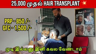 25000 முதல் Hair transplant 💥 Chennai Hair Studio Trichy  Affordable Hair Transplant In the world [upl. by Vas]