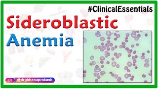 Sideroblastic Anemia  Causes Pathogenesis Clinical Presentation Diagnosis Treatment [upl. by Noivad240]