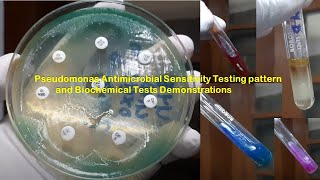 Pseudomonas Antimicrobial Sensitivity Testing pattern and Biochemical Tests Demonstrations [upl. by Yadseut]