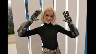 Meet Tilly Lockey Bionic Woman [upl. by Dranrev]