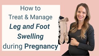 How to Reduce Leg and Foot Swelling during Pregnancy [upl. by Bernardo580]