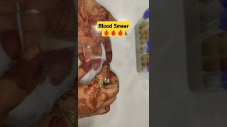 Blood Smear lab ytshorts medical shortsfeed safecarepoint [upl. by Romano]