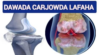 DAWADA LO QAATO LAFAHA KALA BAXYADA CARJOWDA JILBAHA DHABARKA SINTA QOORTA GLUCOSAMINE amp CHONDROTIN [upl. by Qerat924]