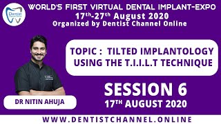 Tilted Implantology using The T I I L T Technique Dr Nitin Ahuja  Session 6 [upl. by Aloz]