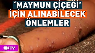 Maymun Çiçeği Hastalığının Belirtileri Neler  NTV [upl. by Benedetta373]