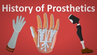 The History Of Prosthetics Explained [upl. by Lleroj]