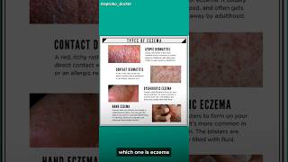 Doctor explains What causes Eczema [upl. by Eerdna]