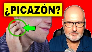 PICOR COMEZÓN 💥 CAUSAS COMPLICACIONES y ALIVIO [upl. by Afas]