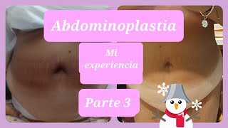 Abdominoplastia mi experiencia Parte 3 Testimonio real [upl. by Ernest]